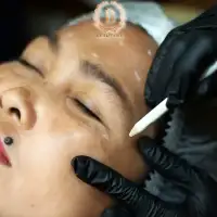 Kerutan Halus di Dahi Dan Filler Hidung